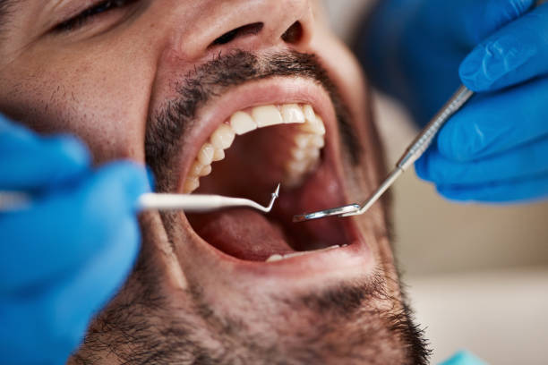 Emergency Gum Pain Relief in IN
