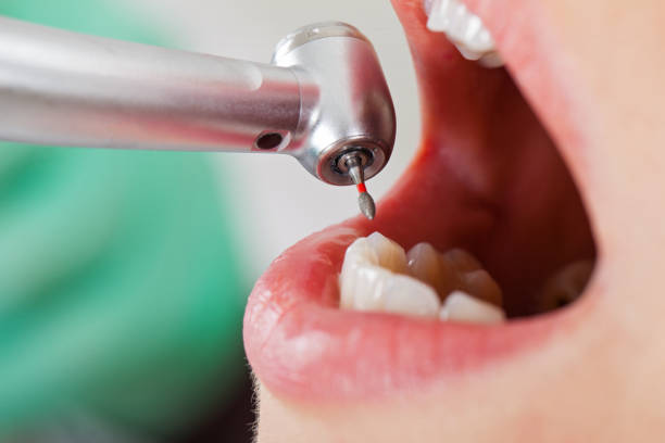 Best Dentist for Tooth Abscess  in Greenville, IN